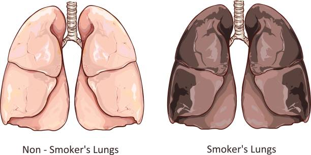 causes and risk factors of ILD