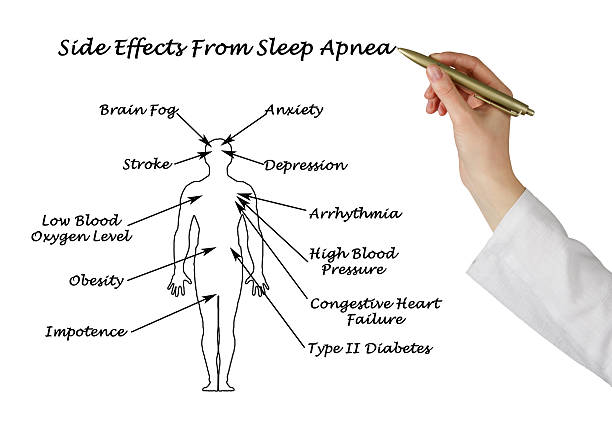 Picture4 sleep apnea side effects in women