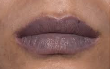 Blue Discoloration of Lips or Nails - drmanumadan.com Blue Discoloration of Lips or Nails
