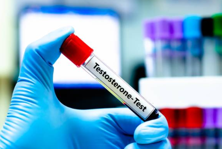 Gloved hand holding a test tube labeled 'Testosterone-Test' in a laboratory setting.