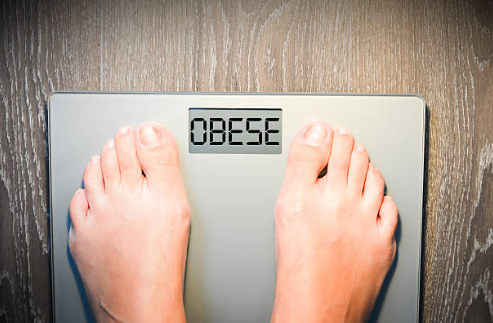 Top-down view of feet on a digital bathroom scale displaying 'OBESE'.