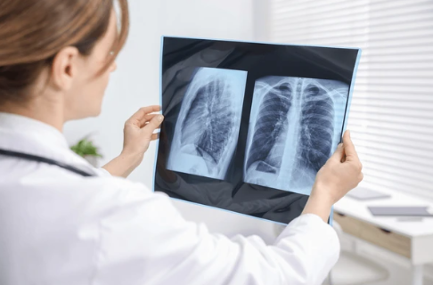 Medical professional in a white coat holding chest X-ray film with two views, examining them in a clinical setting.