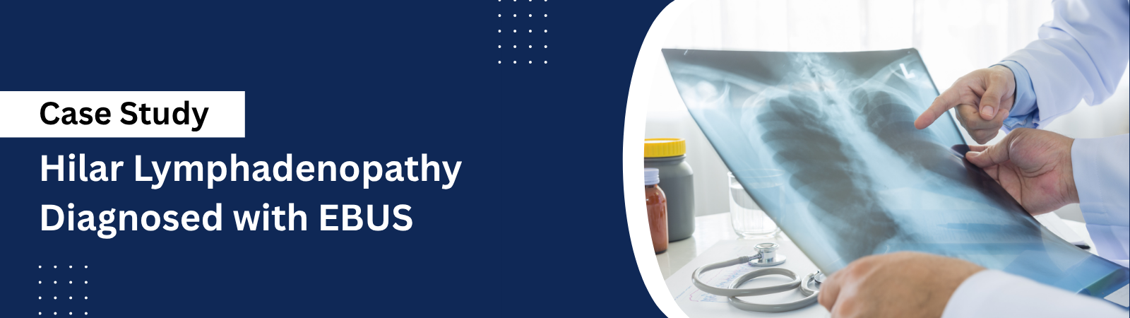 Case study banner: Hilar lymphadenopathy diagnosed with EBUS, doctors reviewing a chest X-ray image on film.