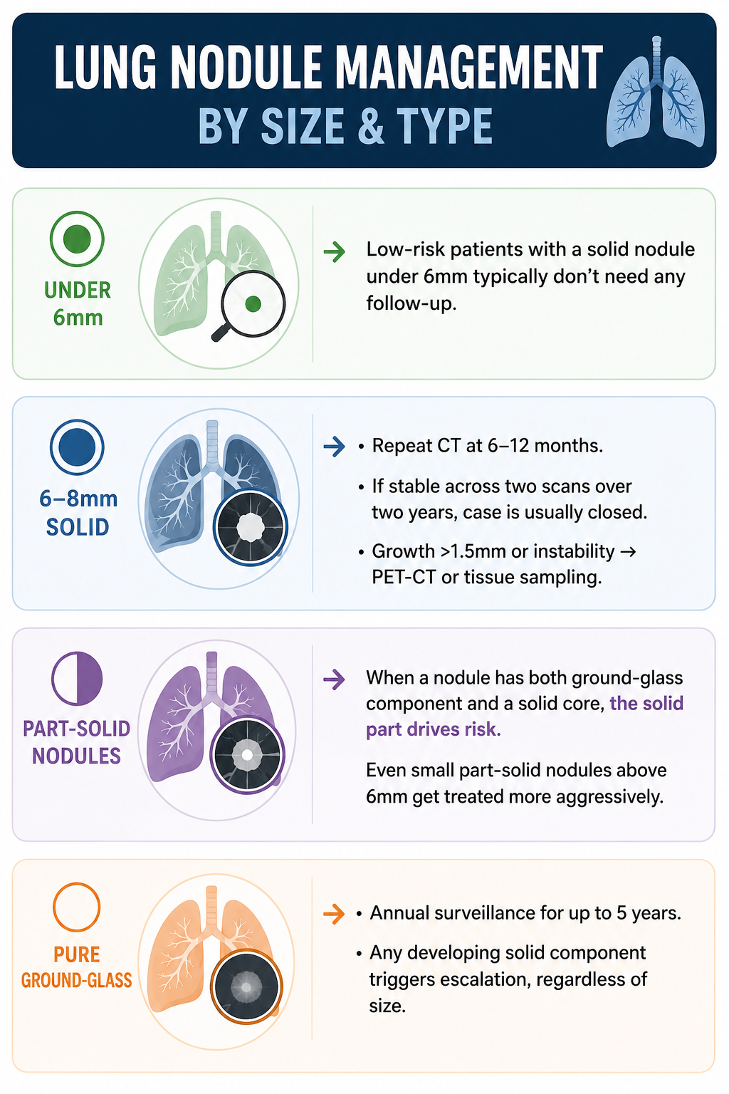 Lung Nodule Management Infographic